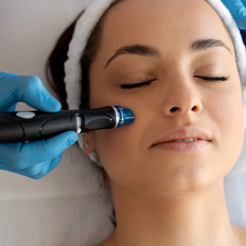 Micro dermabrasion